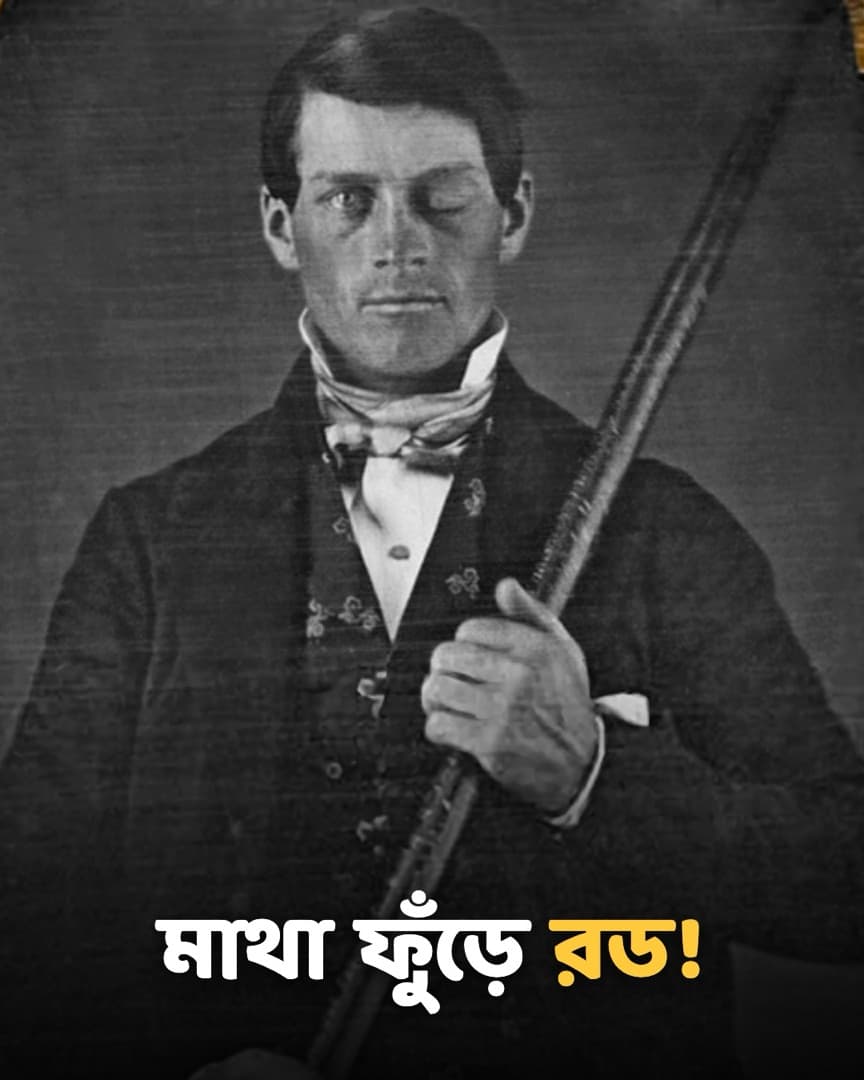 মাথা ফুঁড়ে রড!