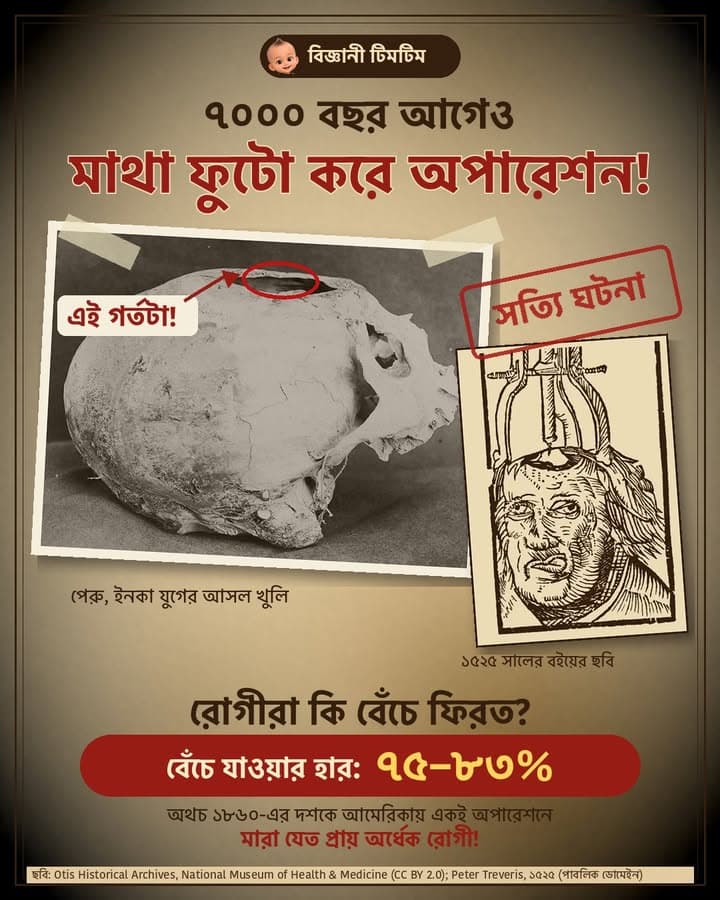 ৭০০০ বছর আগেও মানুষ মাথা ফুটো করে অপারেশন করত!