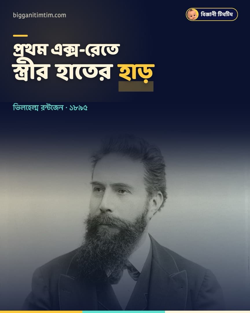 প্রথম এক্স-রে ছবি দেখে স্ত্রী বলেছিলেন, 'আমি নিজের মৃত্যু দেখলাম!'